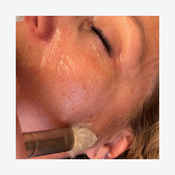  Aloe Vera Mask m. urter