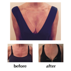 Wonderstripes - Dcollet Pad